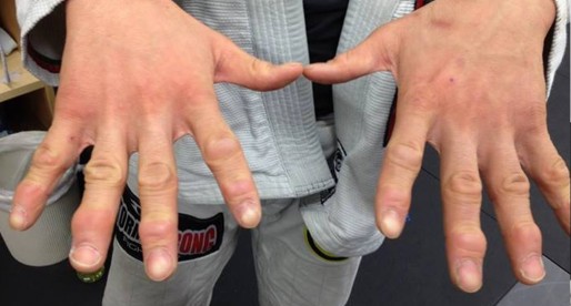 The Science of Taping your Fingers for Jiu Jitsu
